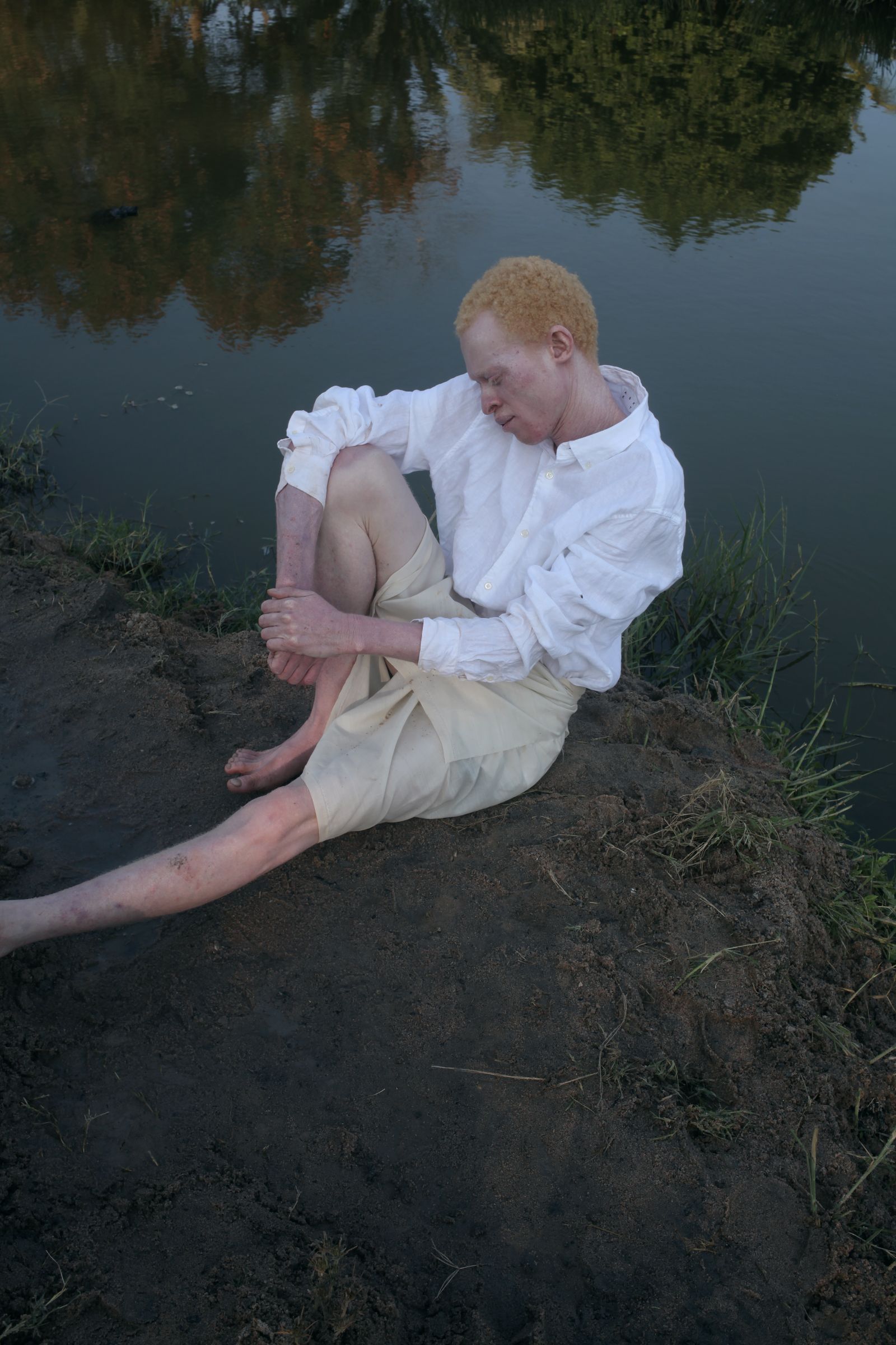 © Denisse Ariana Pérez - Image from the "Albinism, Albinism" Part I & II photography project