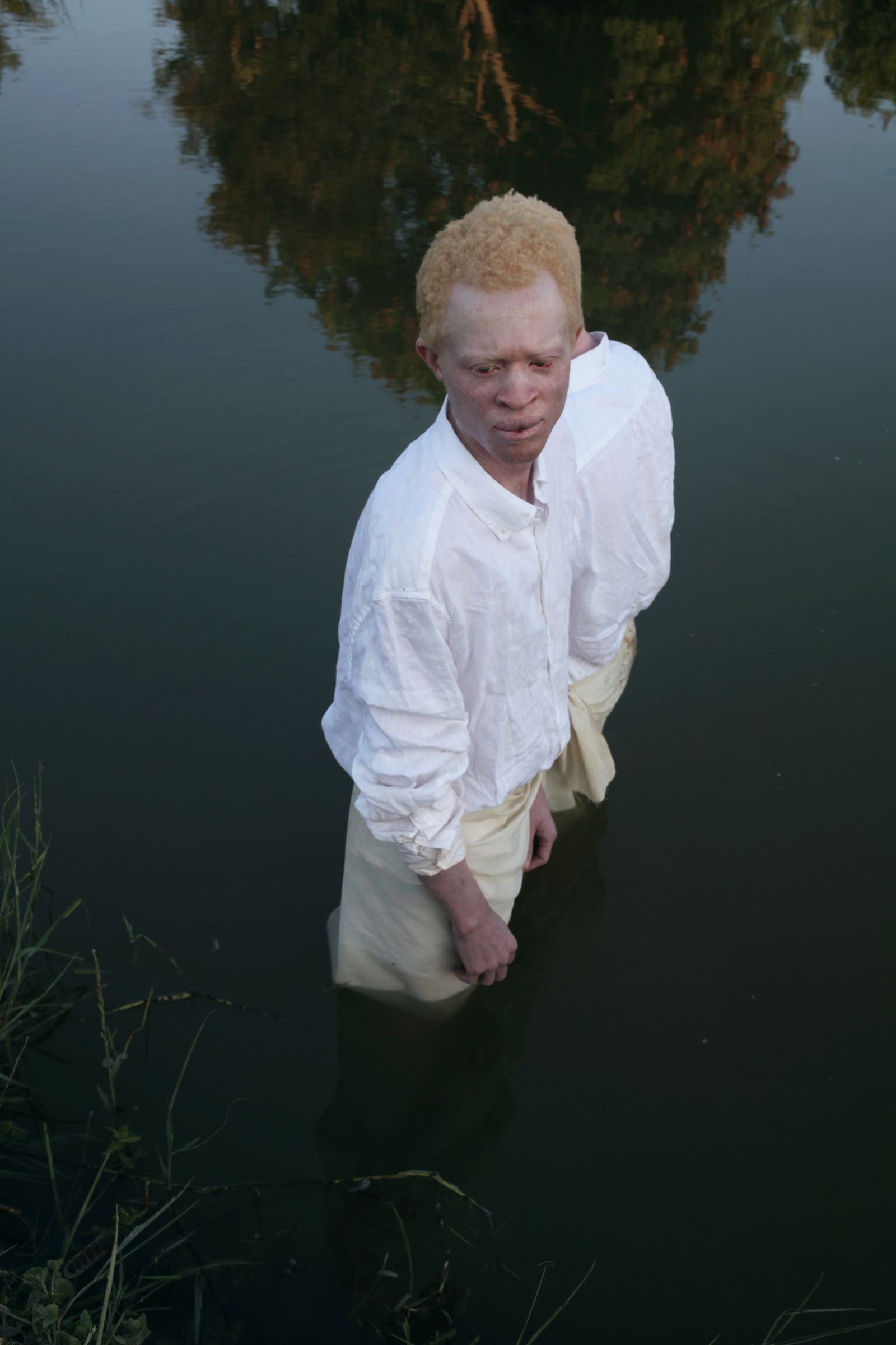 © Denisse Ariana Pérez - Image from the "Albinism, Albinism" Part I & II photography project