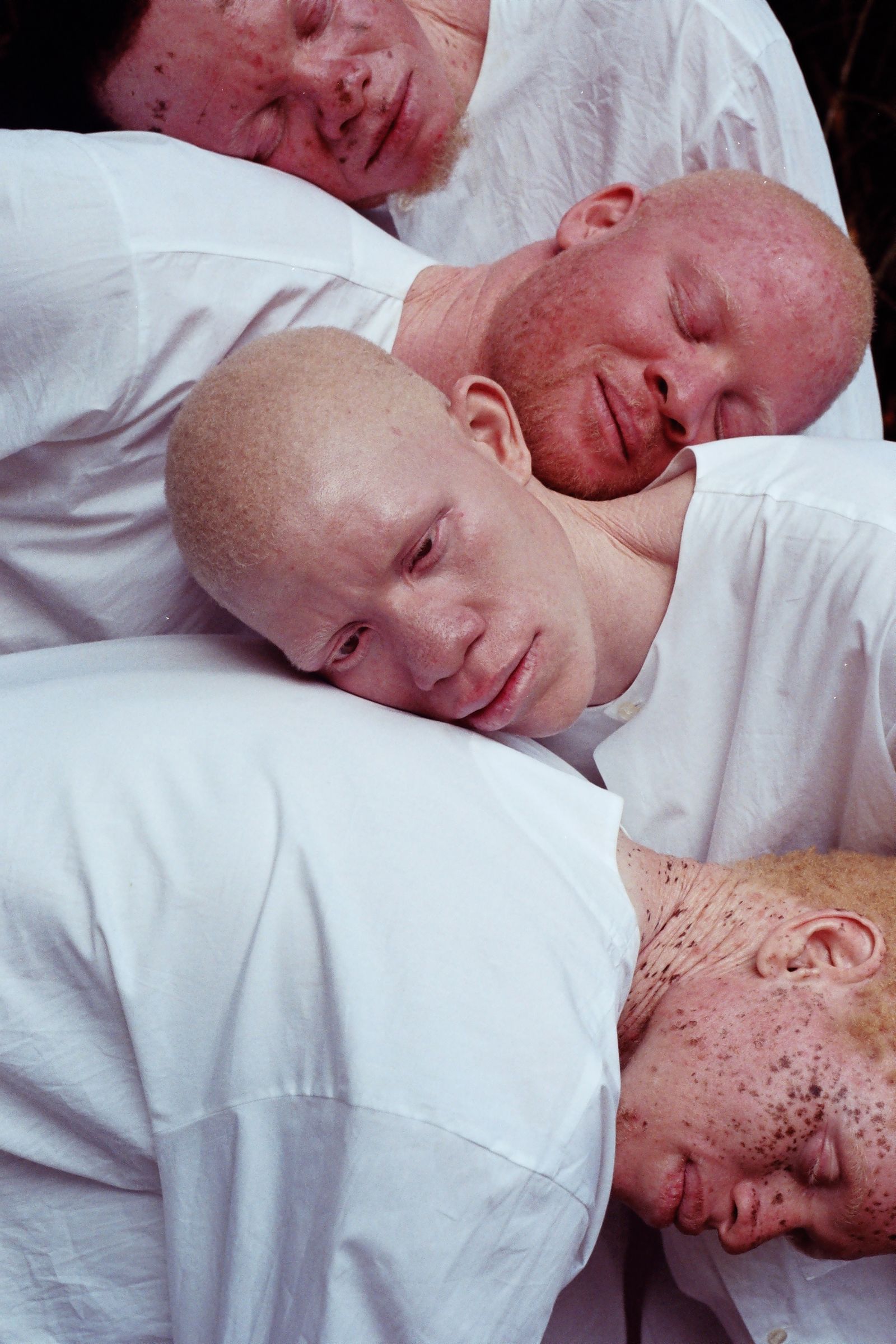 © Denisse Ariana Pérez - Image from the "Albinism, Albinism" Part I & II photography project