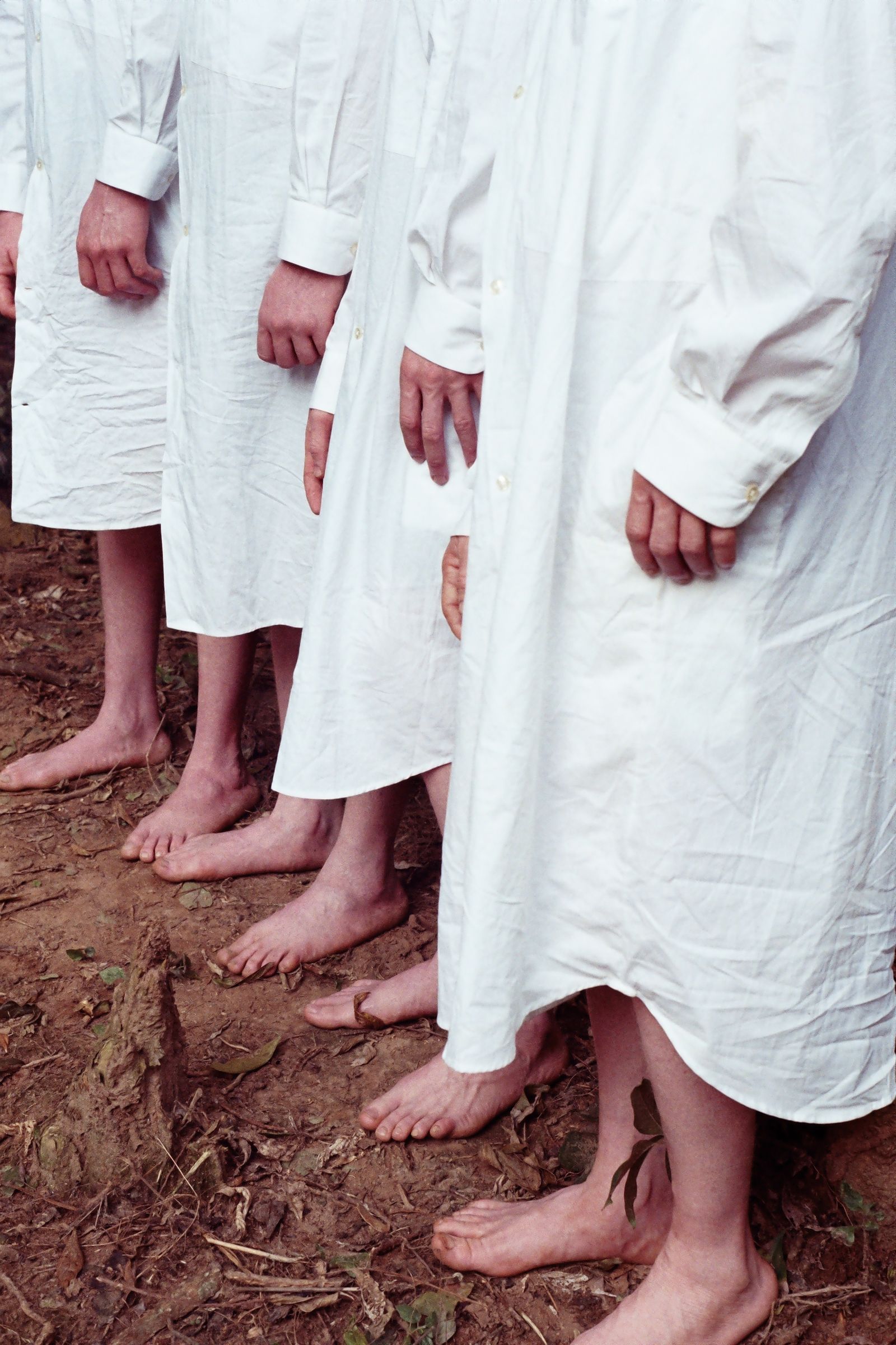 © Denisse Ariana Pérez - Image from the "Albinism, Albinism" Part I & II photography project