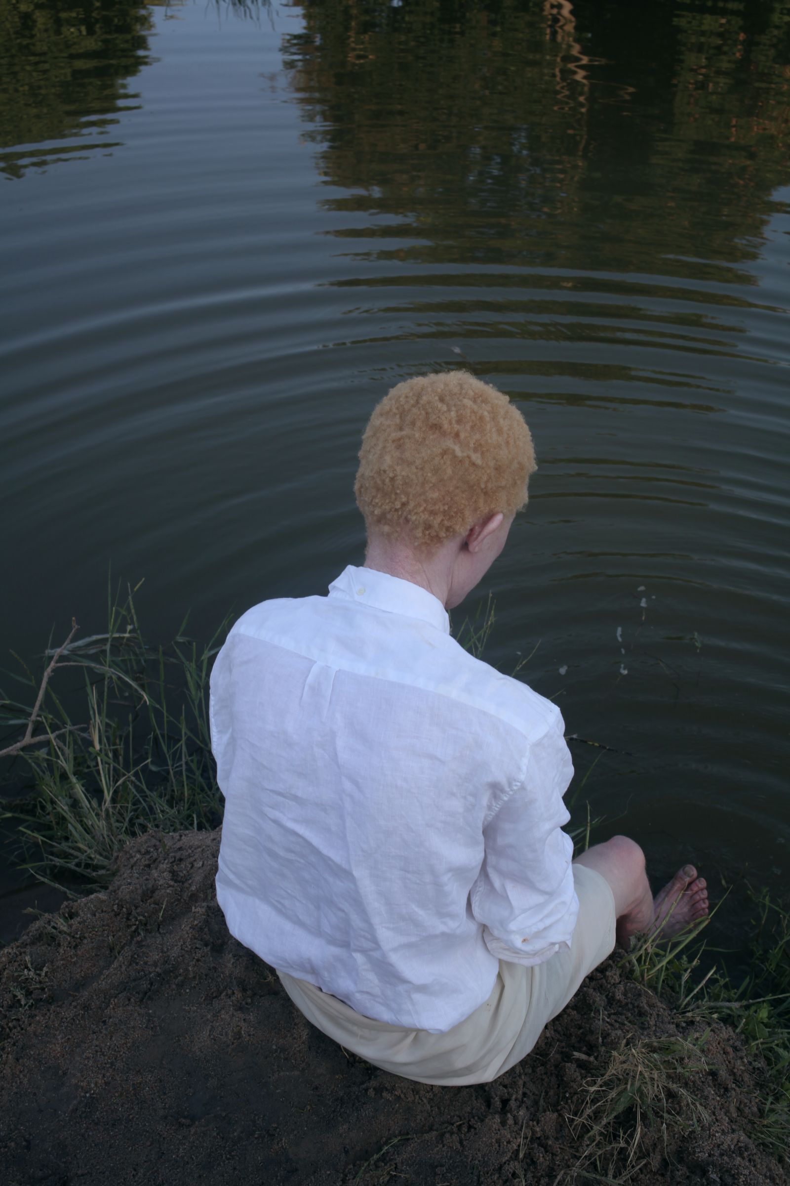 © Denisse Ariana Pérez - Image from the "Albinism, Albinism" Part I & II photography project