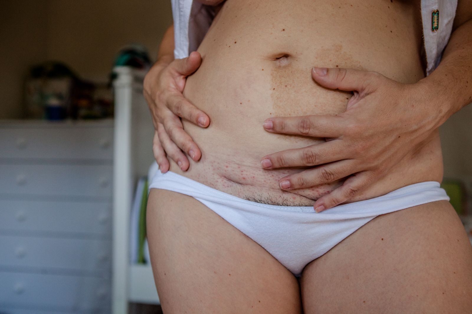 © Leticia Valverdes - Image from the BIRTH MARKS- OBSTETRIC VIOLENCE IN BRAZIL, A CONTEMPORARY HUMAN RIGHTS ISSUE photography project