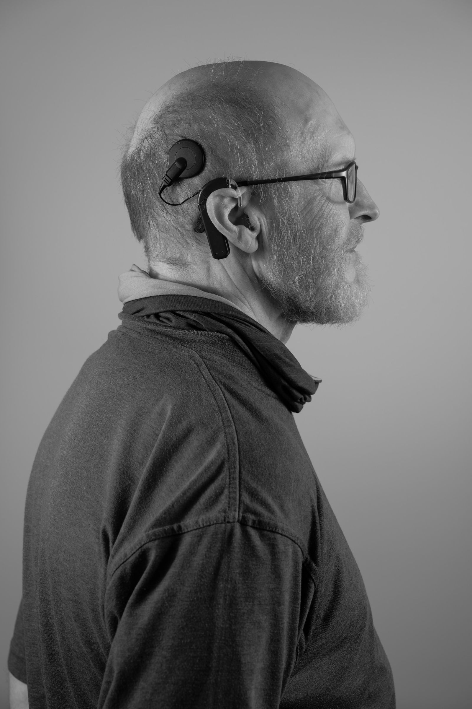 © Aristidis Schnelzer - Patient wearing a cochlear implant.