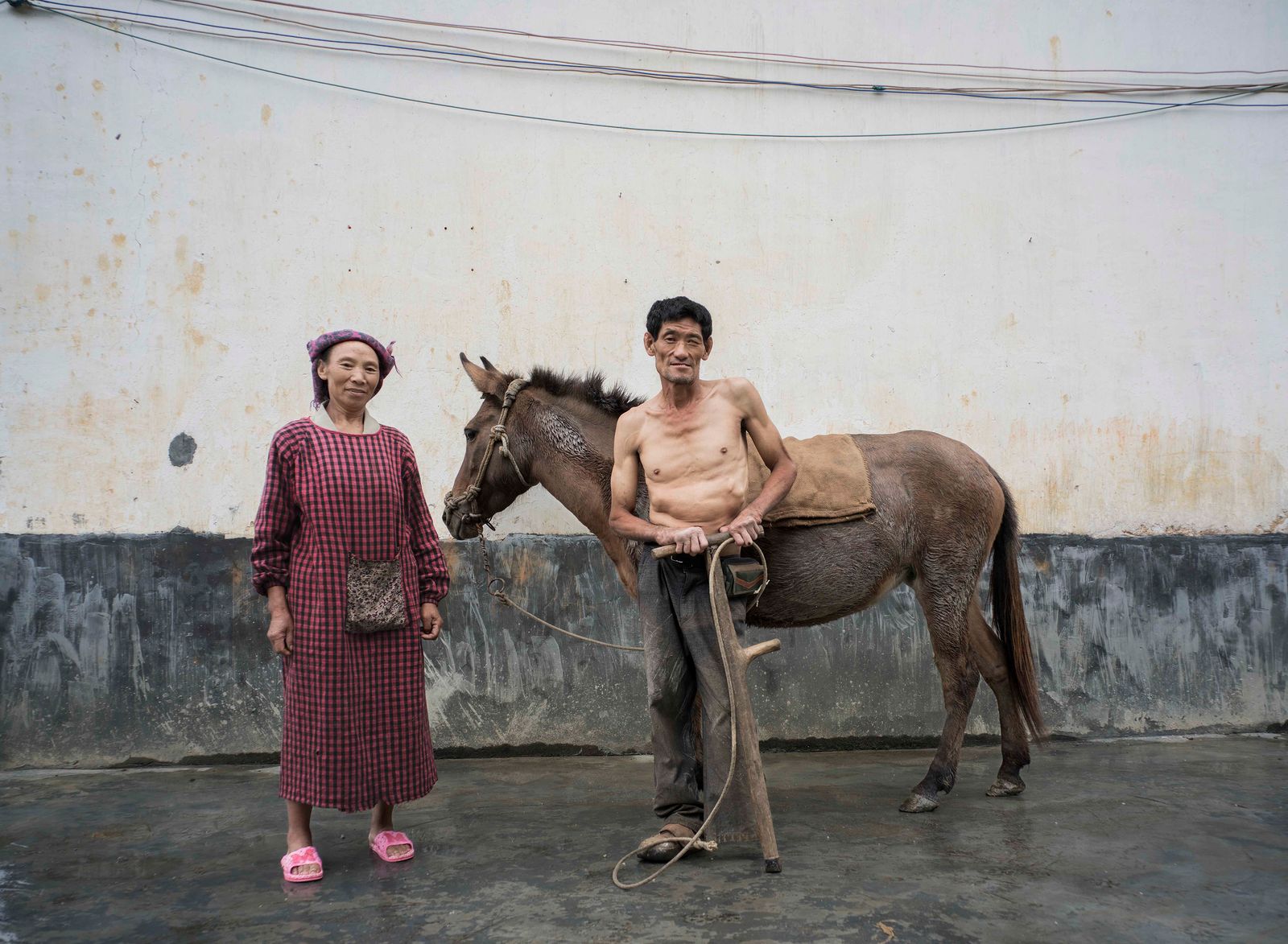 © Jin TIAN - Image from the CURSE OF THE WIND. A HISTORY OF LEPROSY IN CHIN photography project