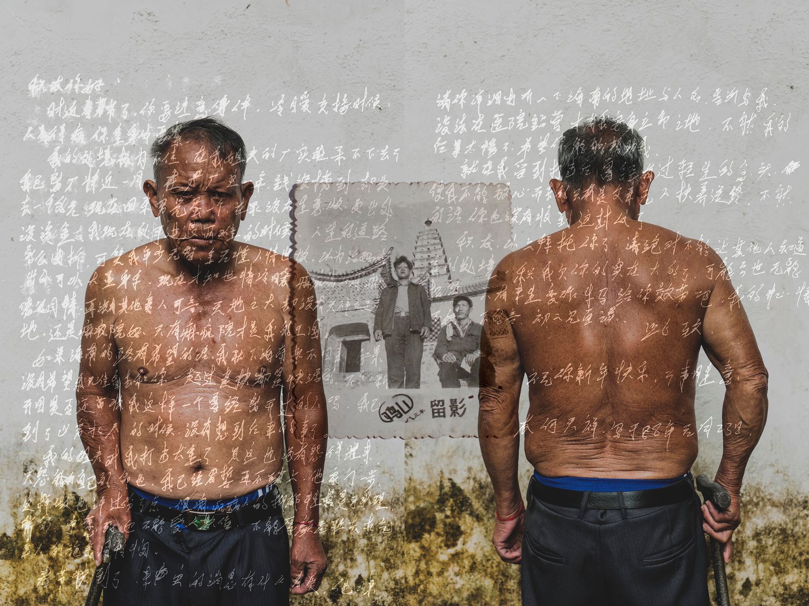© Jin TIAN - Image from the CURSE OF THE WIND. A HISTORY OF LEPROSY IN CHIN photography project