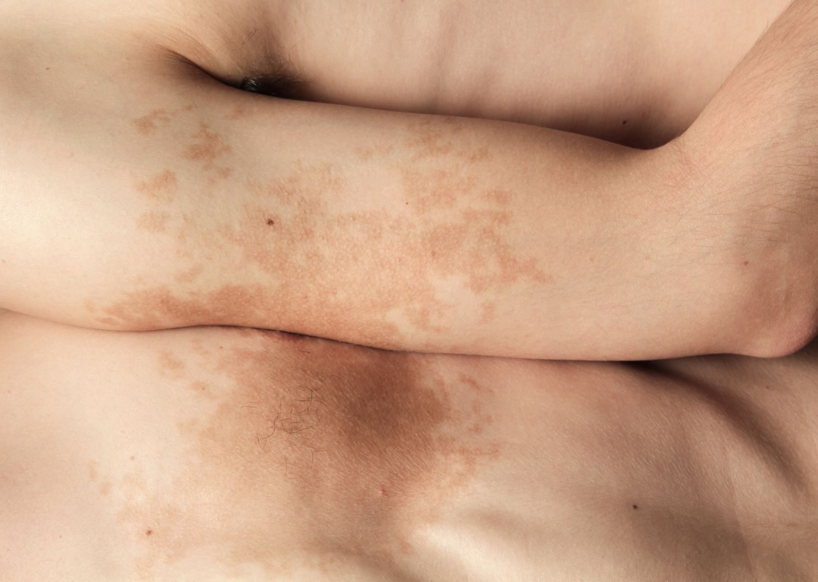 © Alix Marie - Excerpt from the project Bleu