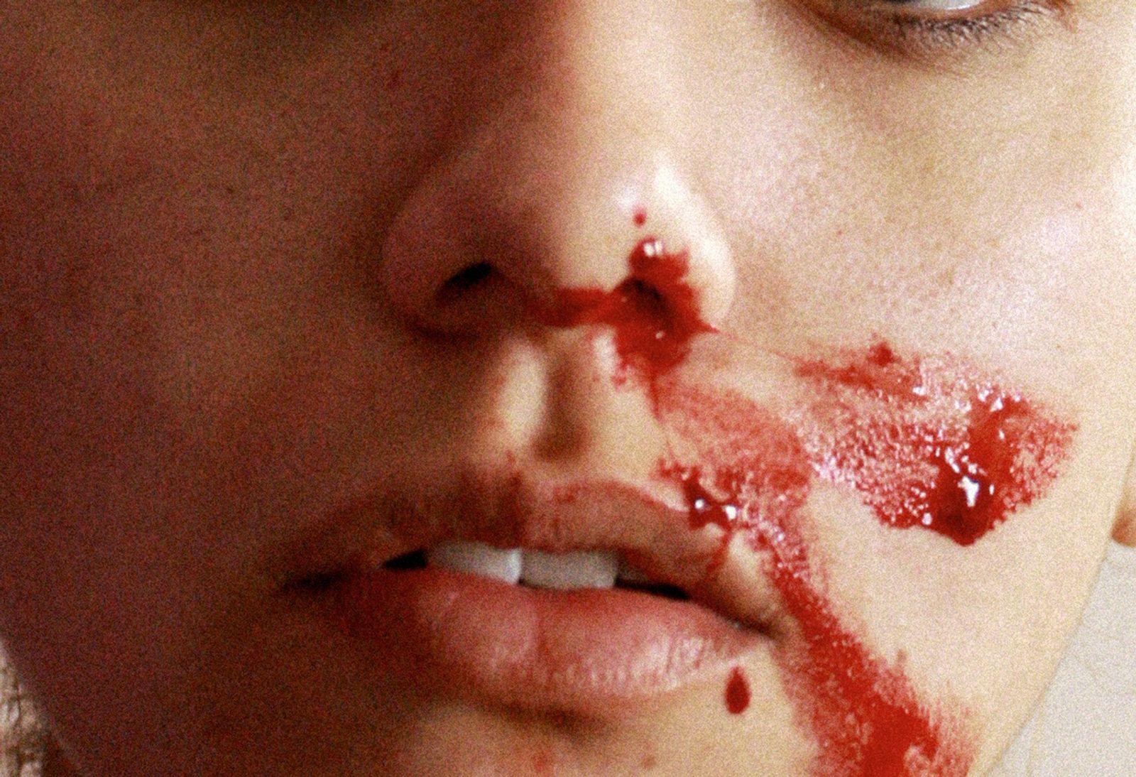 © Glorianna Ximendaz - Self-documentation was my primary tool to overcome and verbalize my trauma.