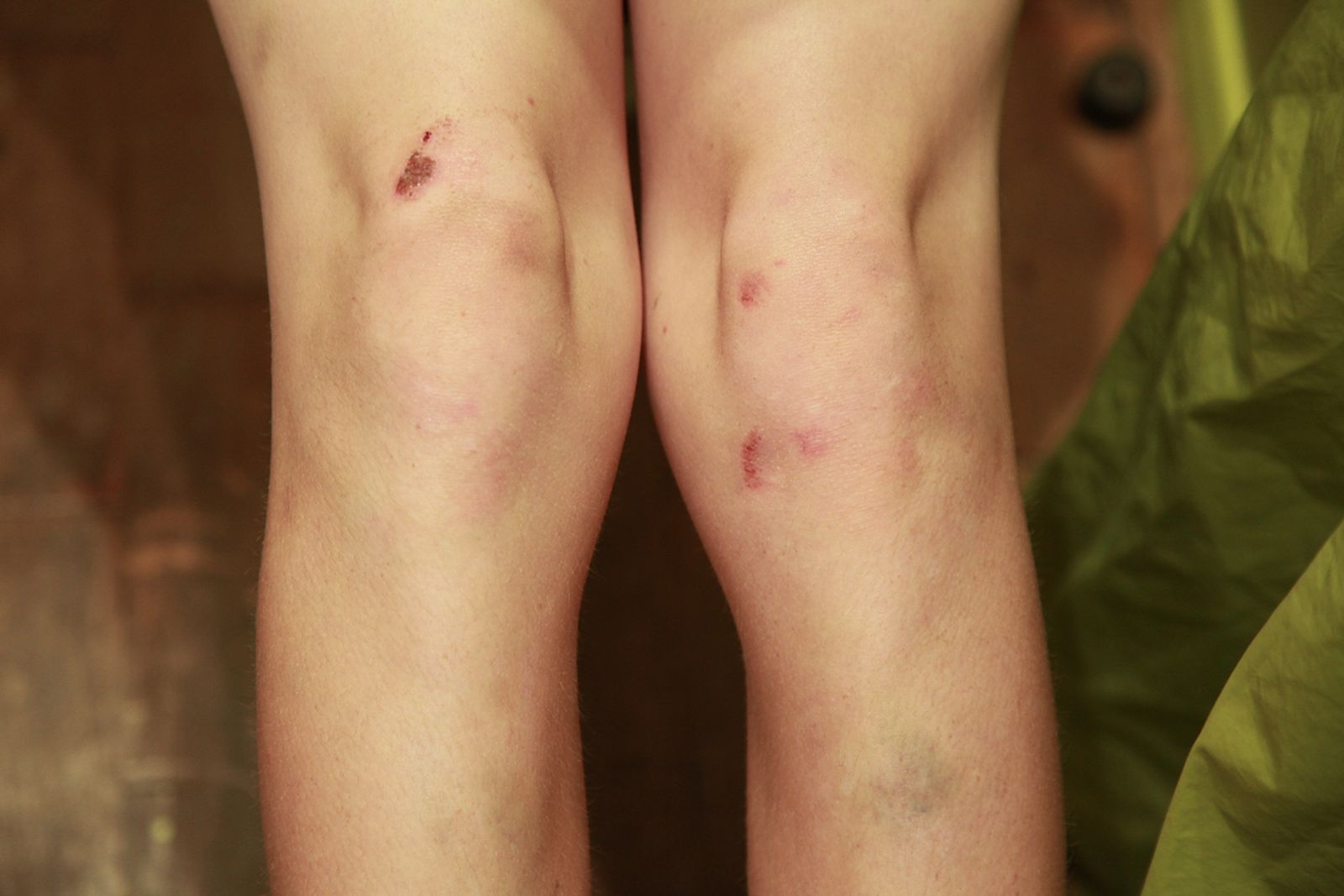 © Heather McDonough - body of a skateboarder