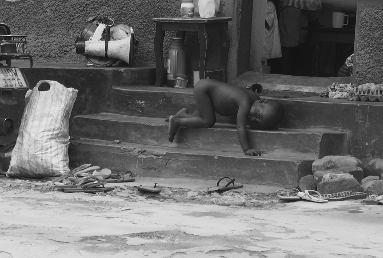 © Rhonda Welch - Malnourished baby in slums of Uganda