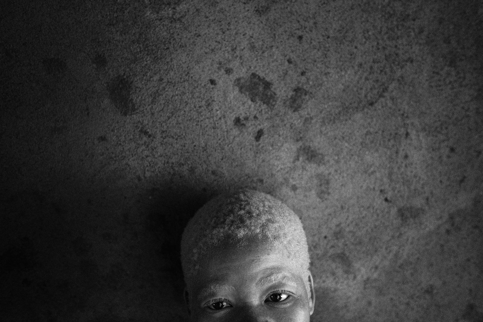 © Daniel Rodrigues - Image from the The hunted - albinos photography project