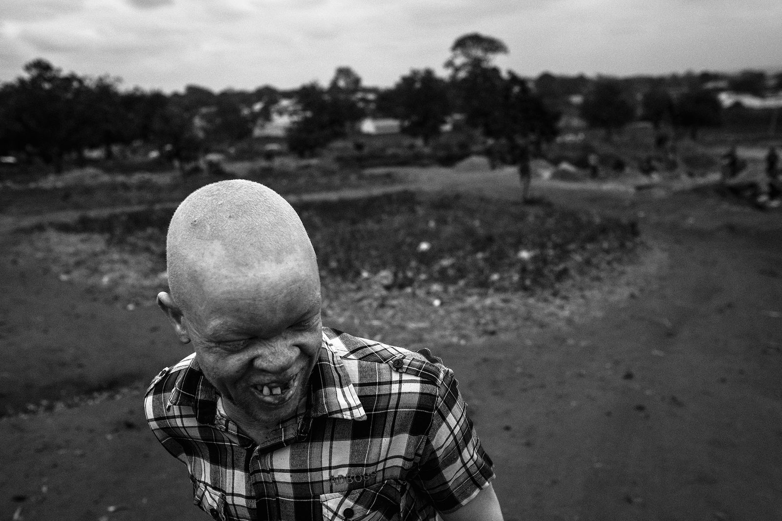 © Daniel Rodrigues - Image from the The hunted - albinos photography project