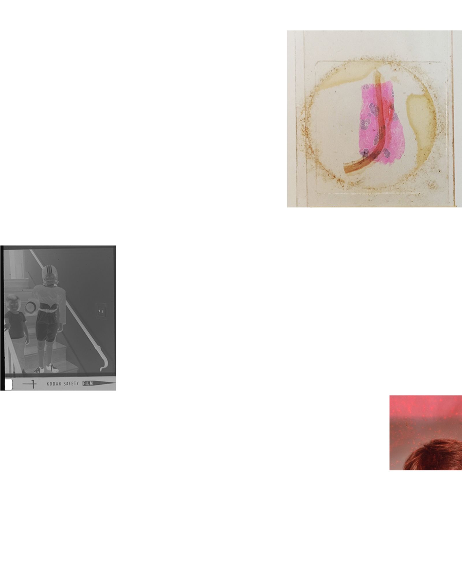 © Susan Worsham - Lactating Mammary Gland through Human Aorta/ Kodak Safety Film/ My brother's stained school headshot.