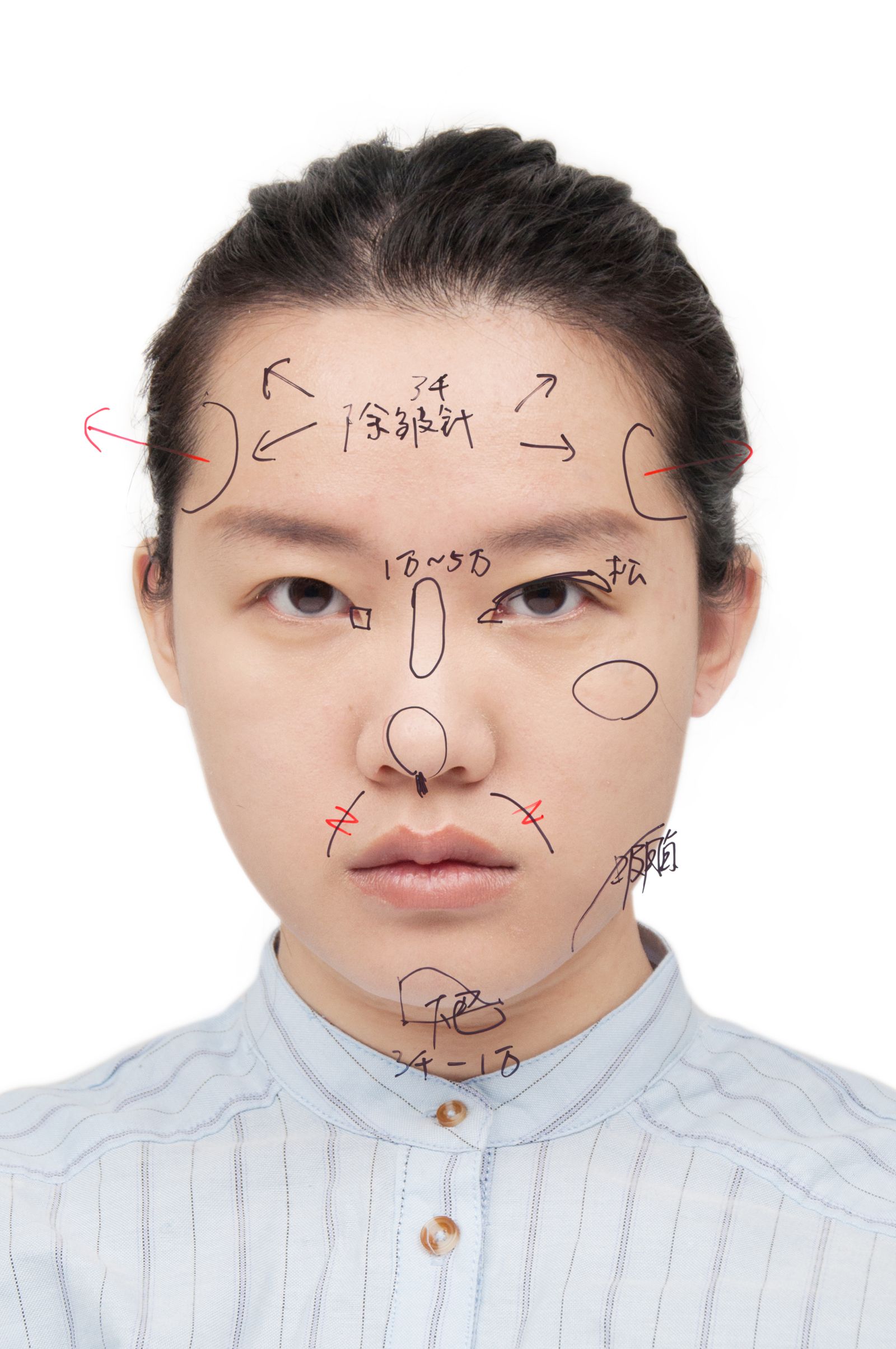 © Yufan Lu - My cosmetic surgery diagnosis 3