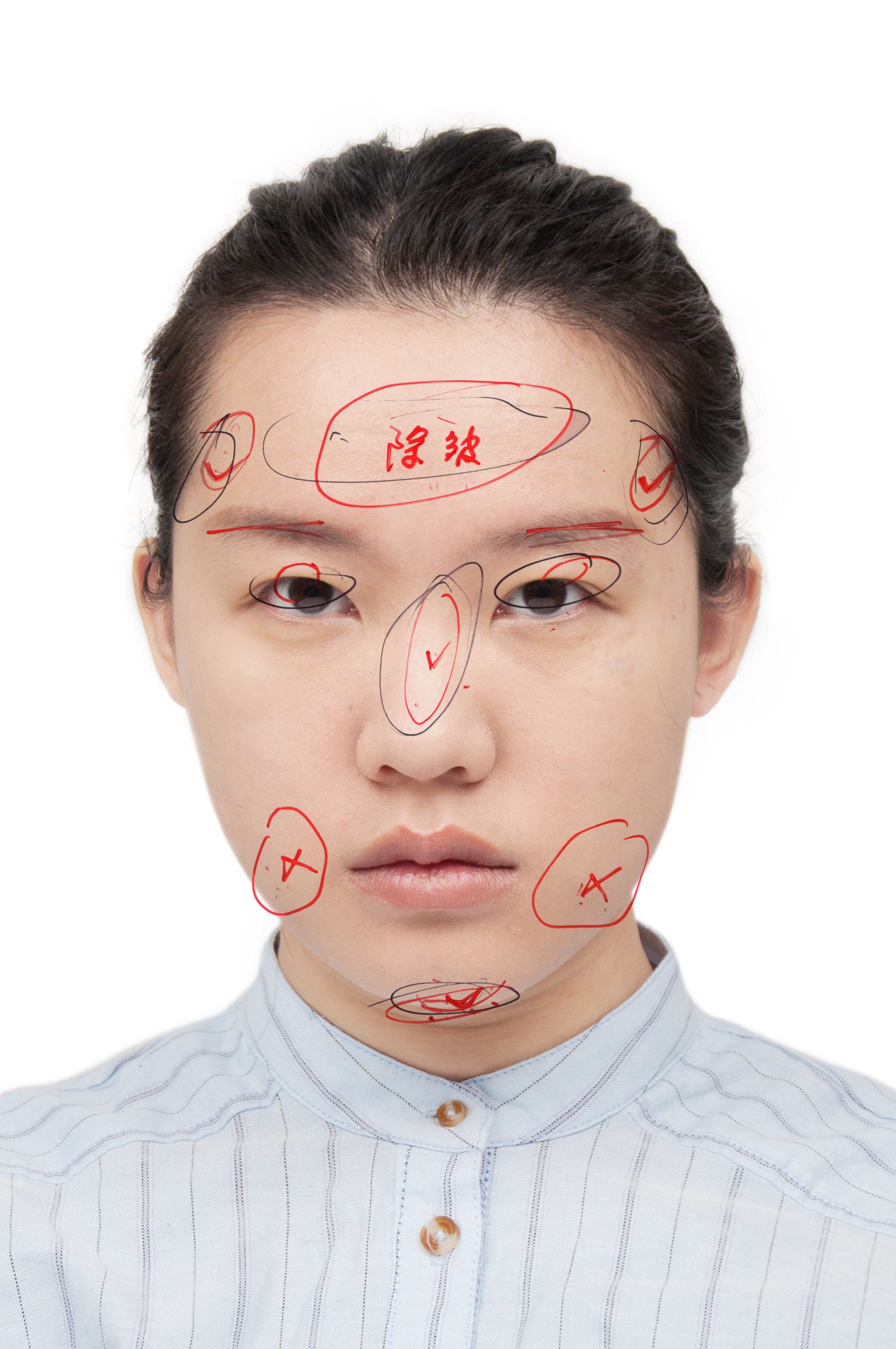 © Yufan Lu - My cosmetic surgery diagnosis 4