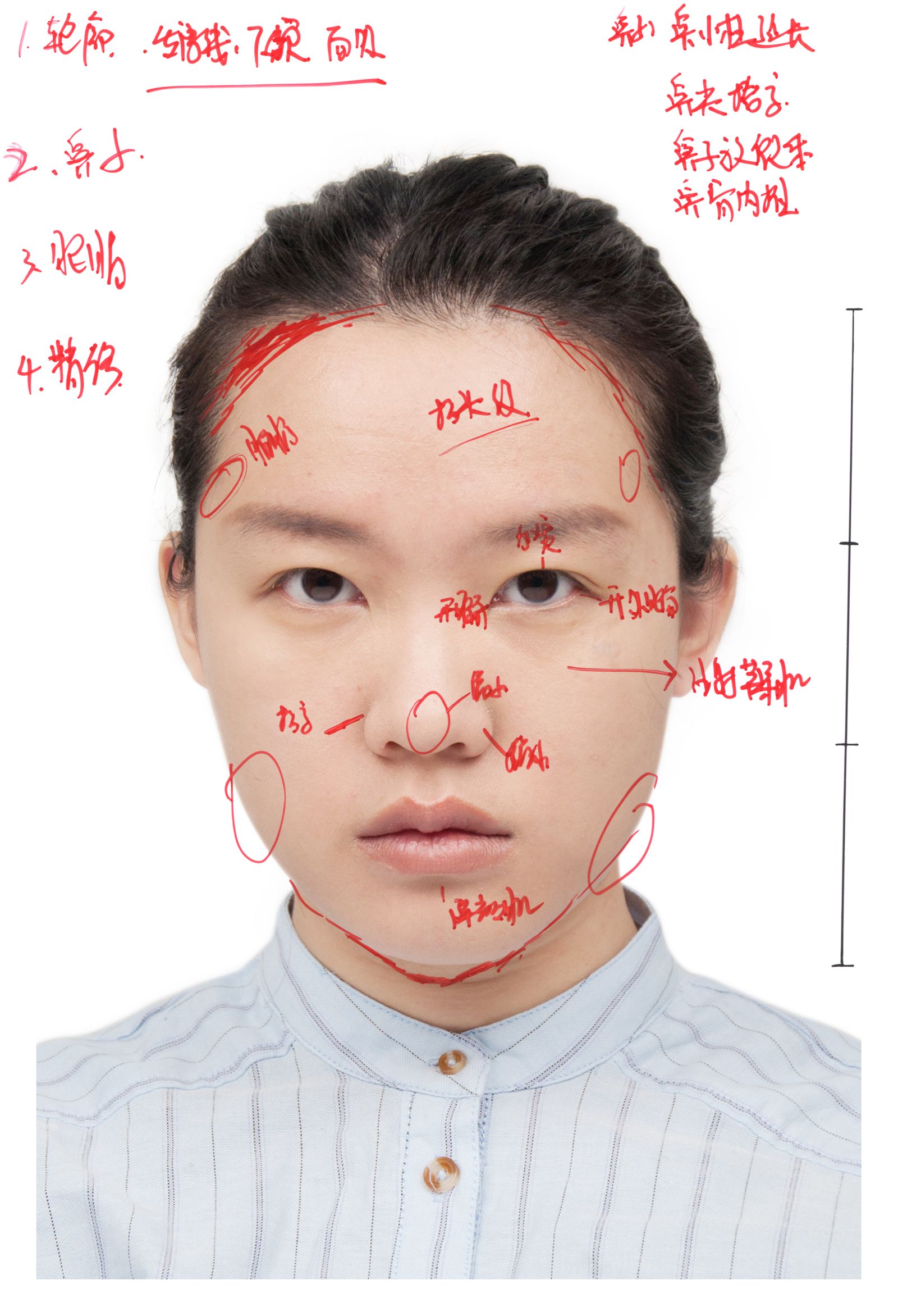 © Yufan Lu - My cosmetic surgery diagnosis 5