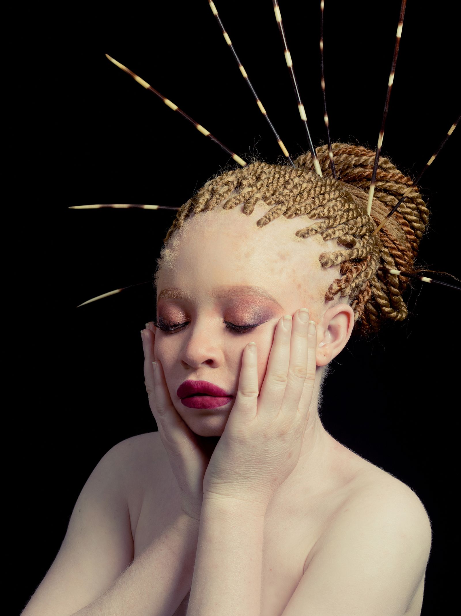 © Hannah Mentz - Image from the Miss Teen Albinism photography project