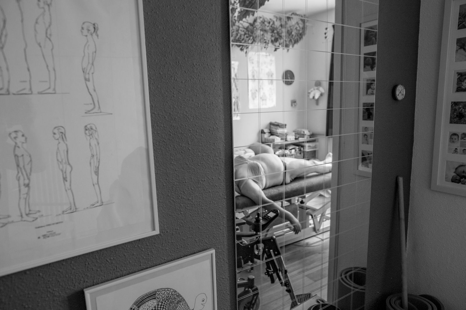 © Michel PETILLO - Claire at the chiropractor. Being in a wheelchair most of the time is damaging to her back.