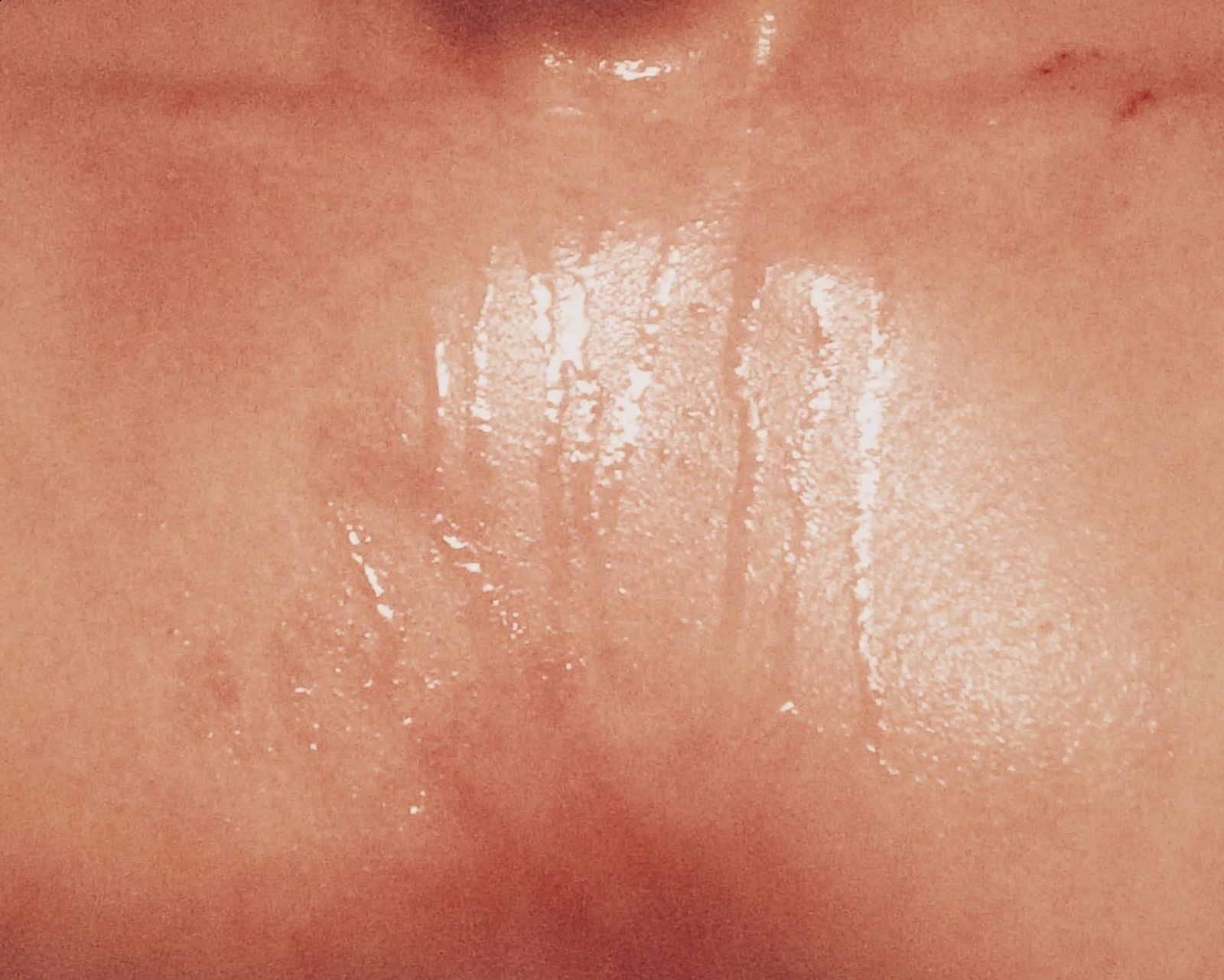 © Andrea Wise - Image from the Hysteria photography project