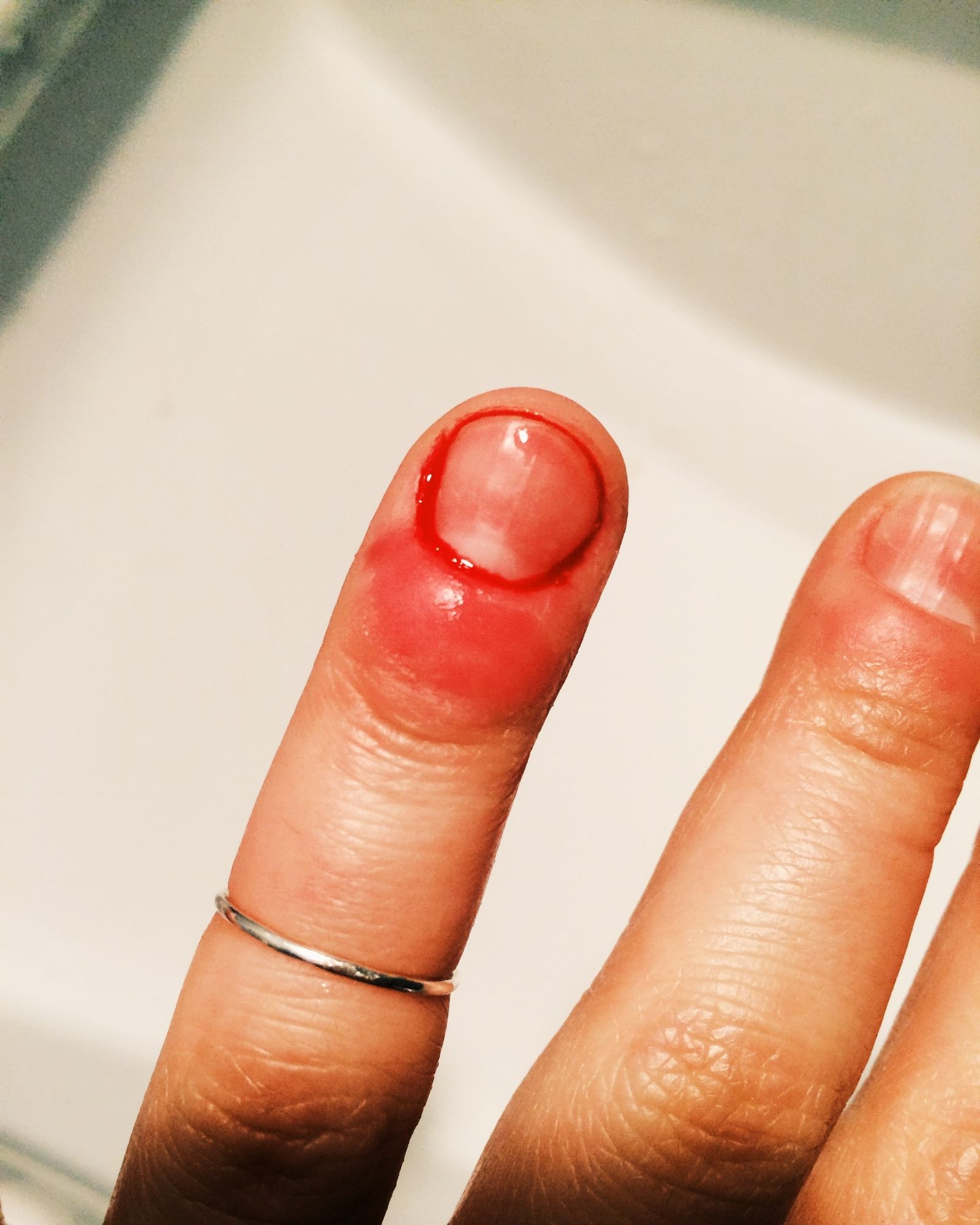 © Andrea Wise - Image from the Hysteria photography project