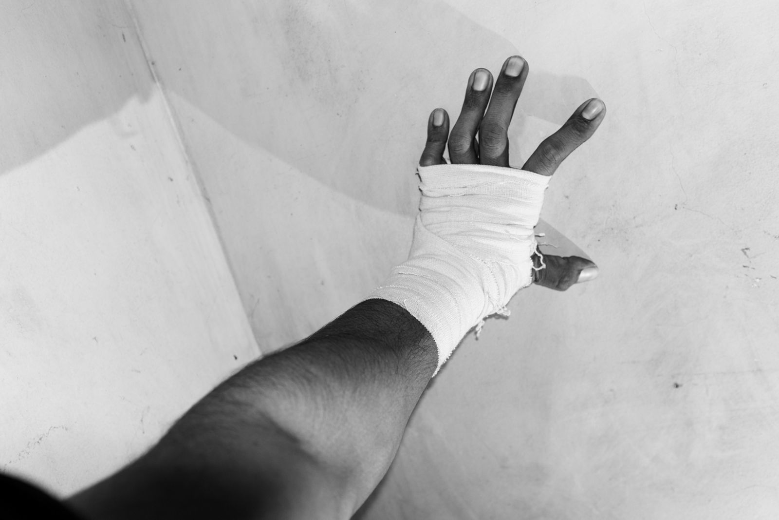 © Mahtab Nafis - Self- Bandaged hand. 2015.