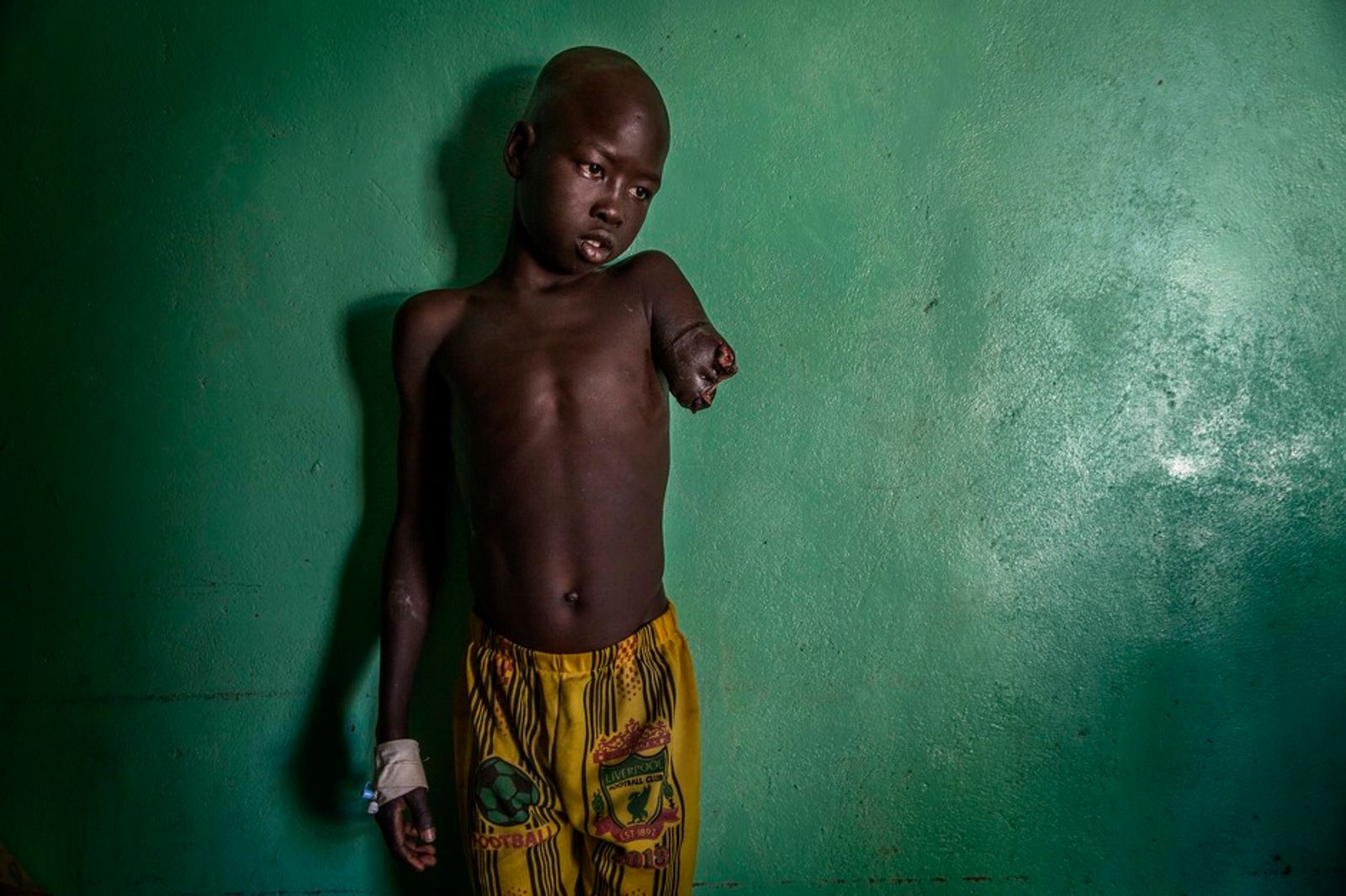 © Marco Gualazzini - Image from the Sudan Border War photography project