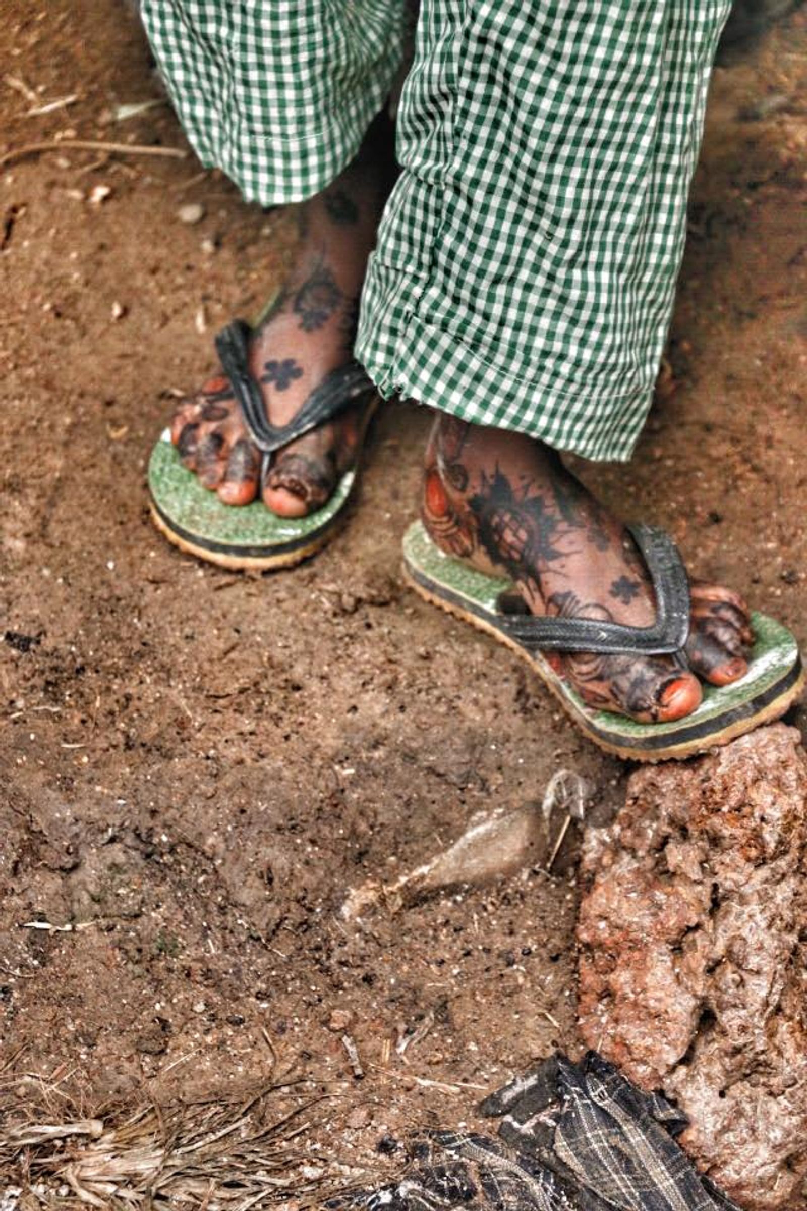 © Iffat Nawaz - Ayesha's feet. Zamfara, Nigeria