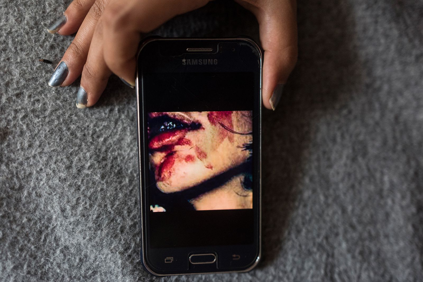© Tanya Habjouqa - Documentation of the abuse by her ex husband, she fled before he killed her through bathroom window.