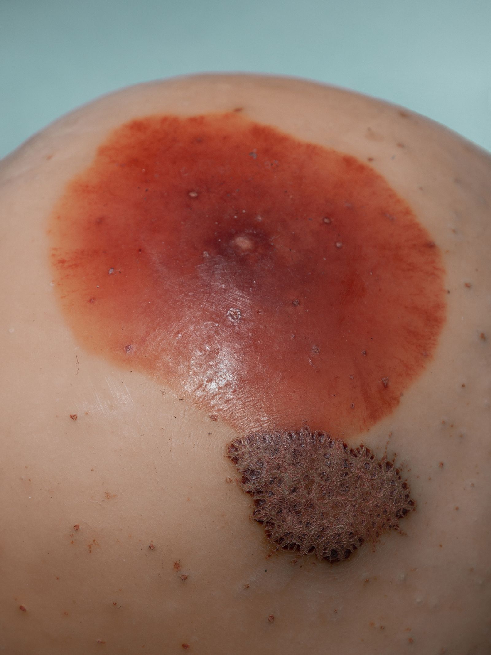 © Nika Sandler - Image from the Plant and Human Pain photography project