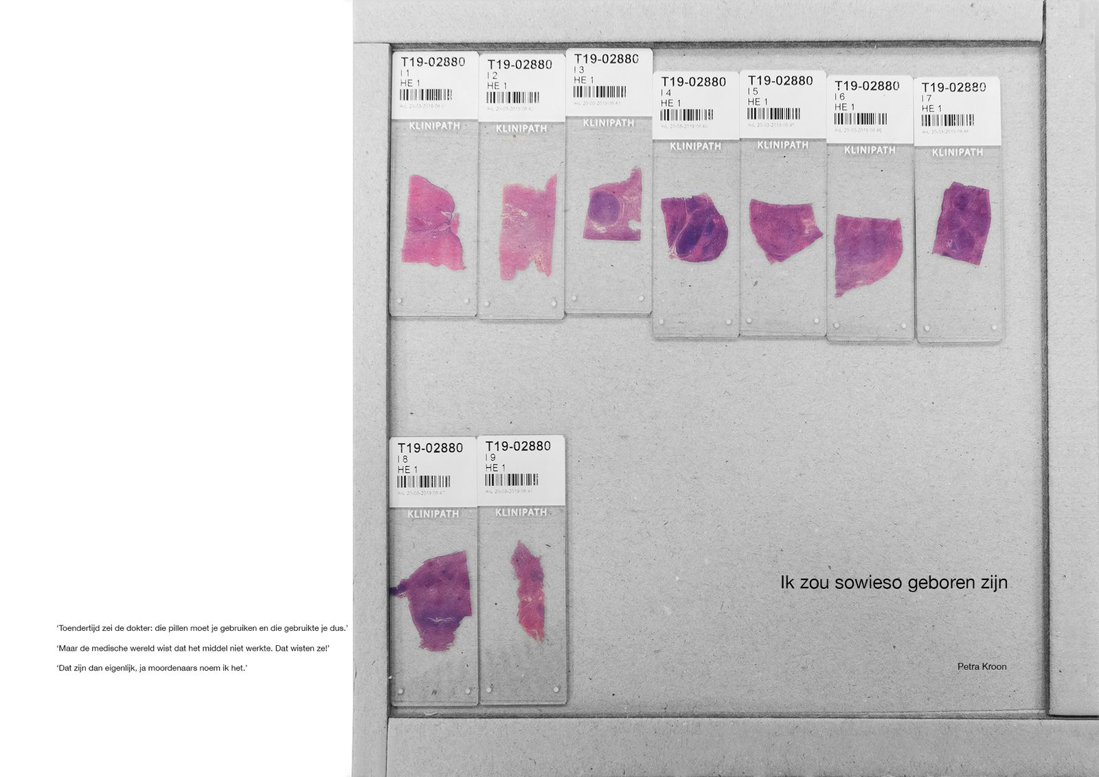 © Petra Kroon - Slides of tissue, Dutch Cancer Institute