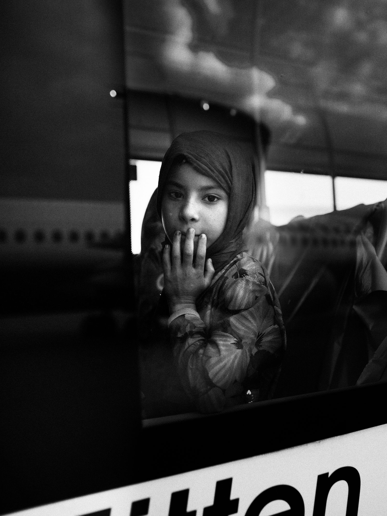 © Toby Binder - A girl from Afghanistan is waiting on a bus at the airfield for the departure to the hospital.