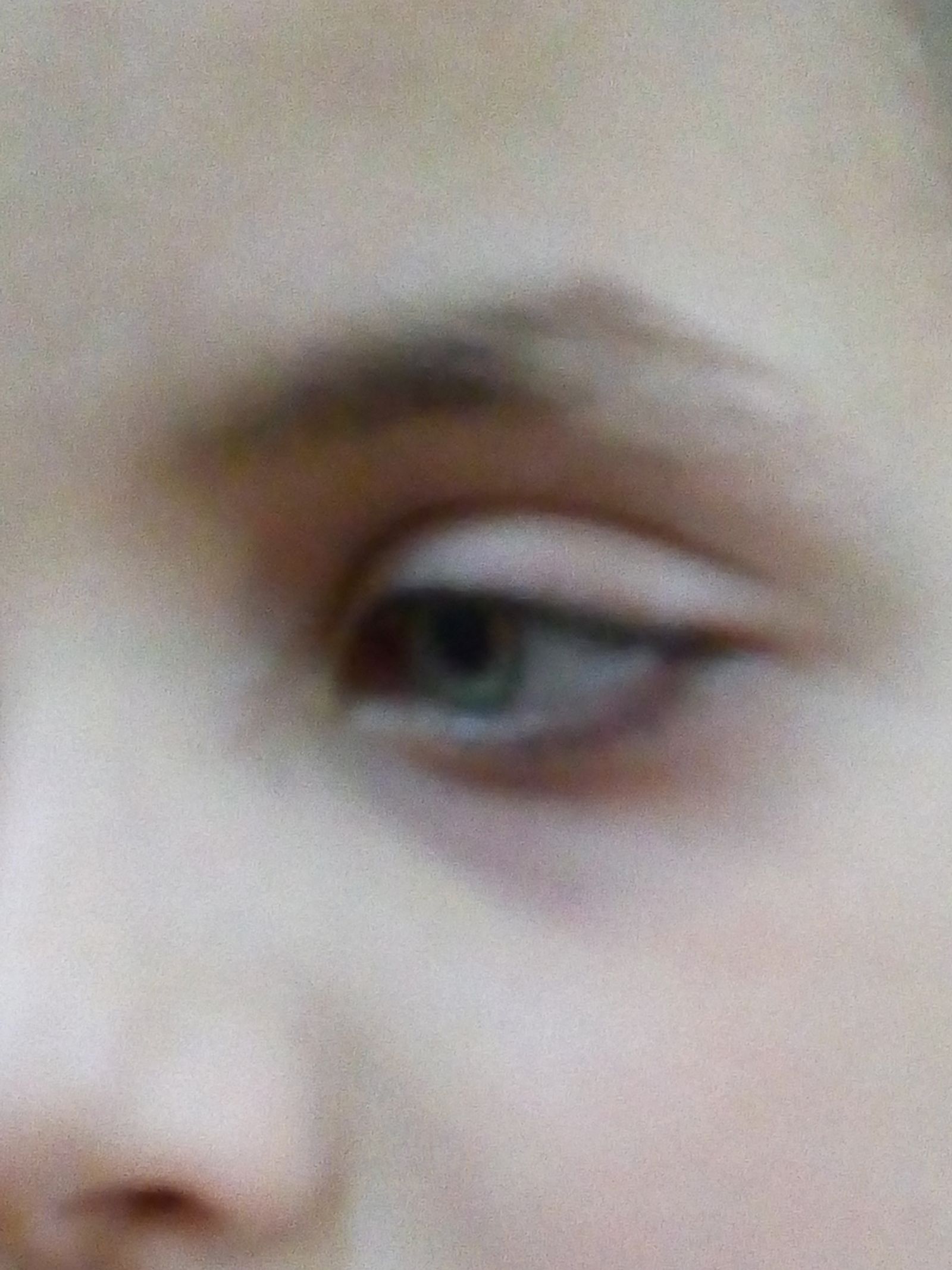 © Sana Ahmadizadeh - “Look at my eye”Cellphone taken by Fahime on request to document her son. Ahvaz, Iran.