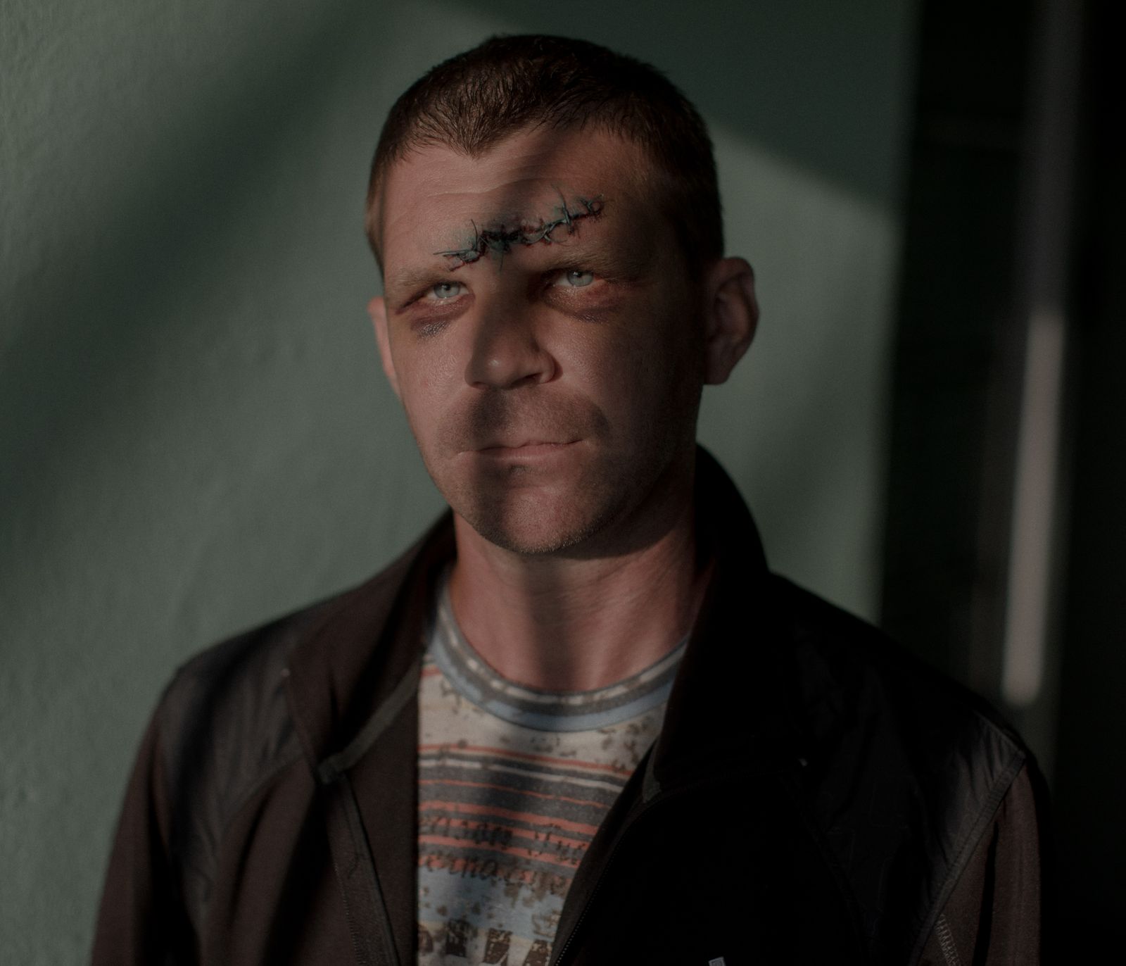 © Jędrzej Nowicki - Image from the The Scars photography project