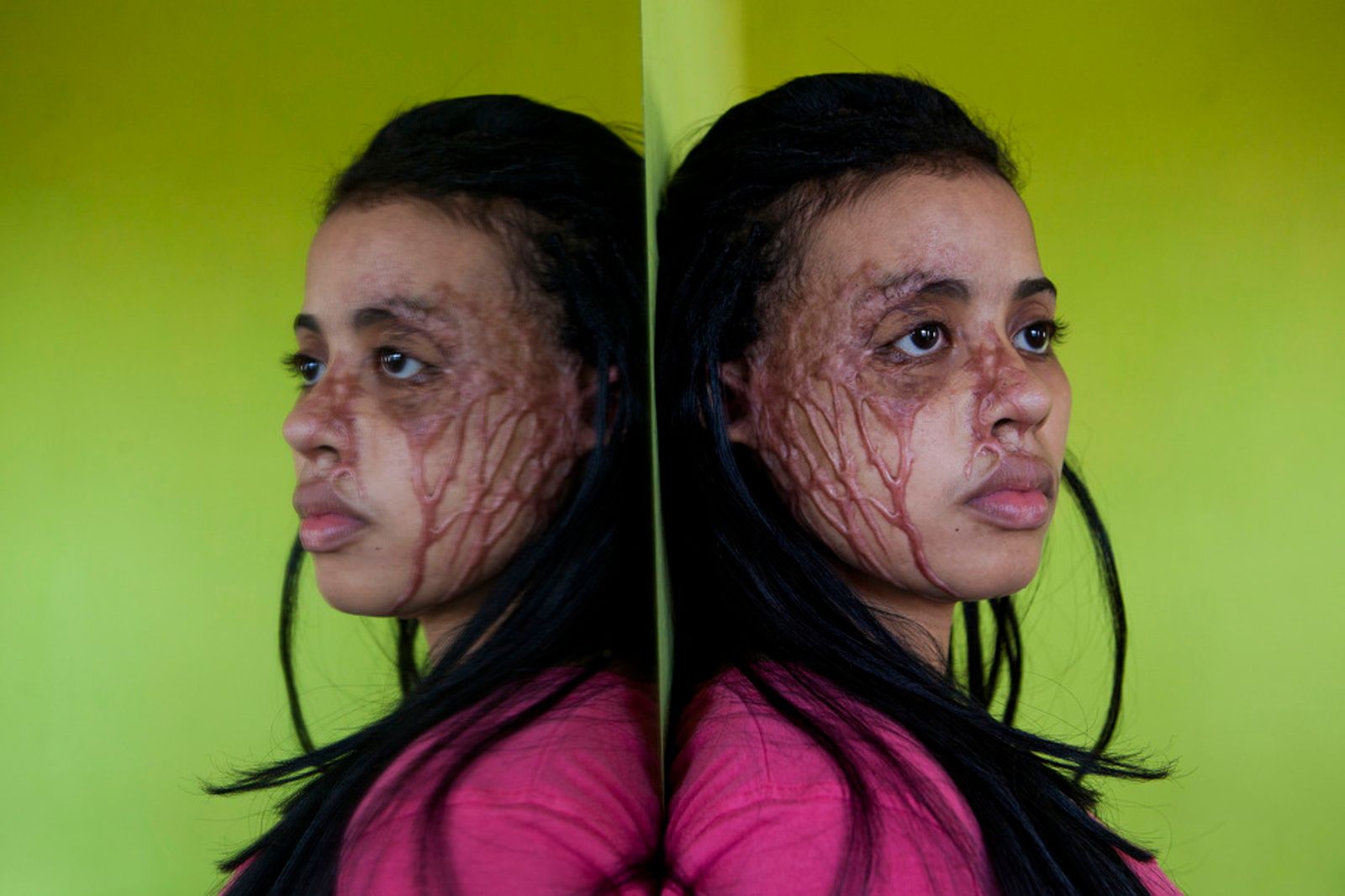 © Orlando Barria Photos - Image from the Women victims of acid photography project