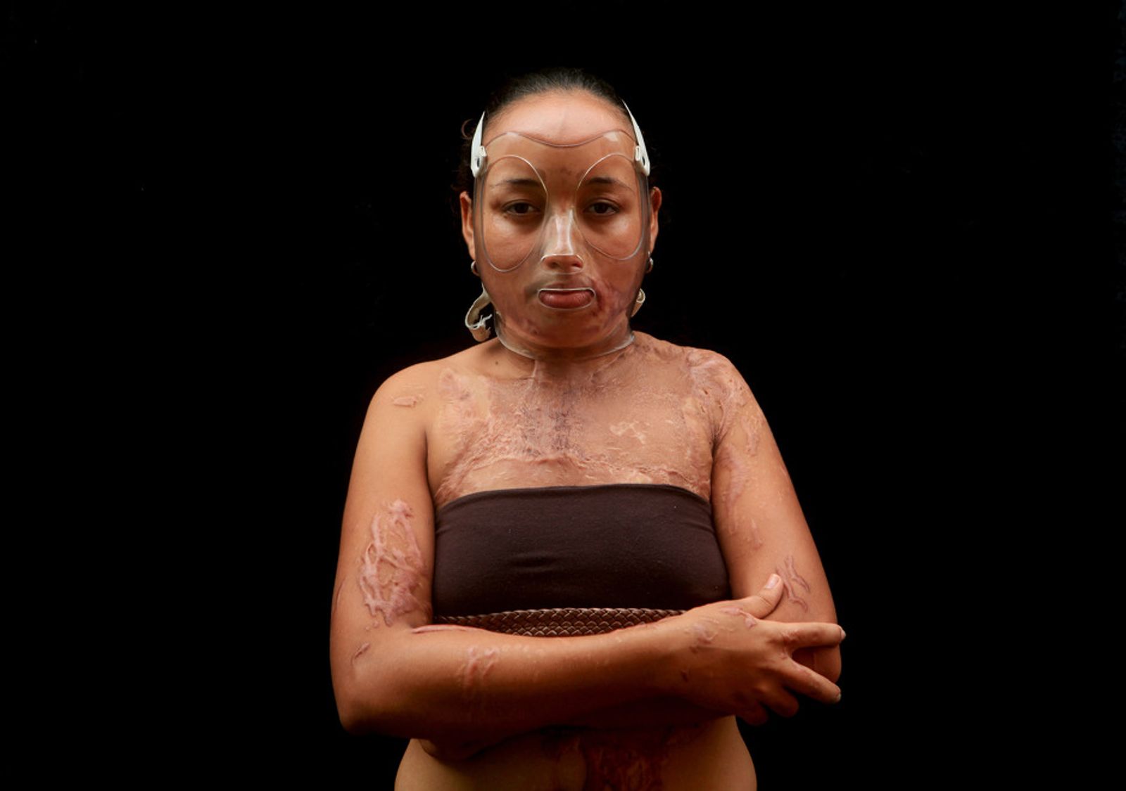 © Orlando Barria Photos - Image from the Women victims of acid photography project