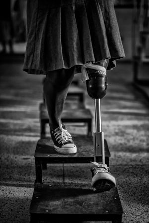 Lost Limbs