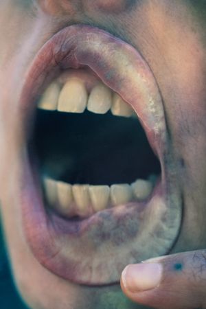 Odontophilia