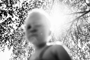 The Hunted - Albinos